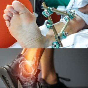Wellhealthorganic Surgery for Wrist and Ankle Injuries